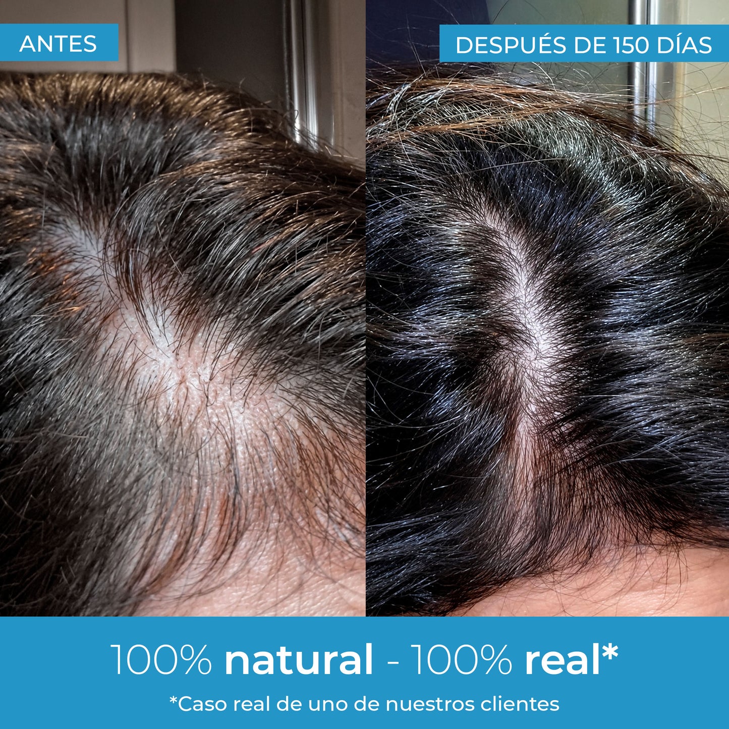Strength Hair Growth Lotion Arganour 50 ml