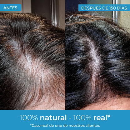 Strength Hair Growth Lotion Arganour 50 ml