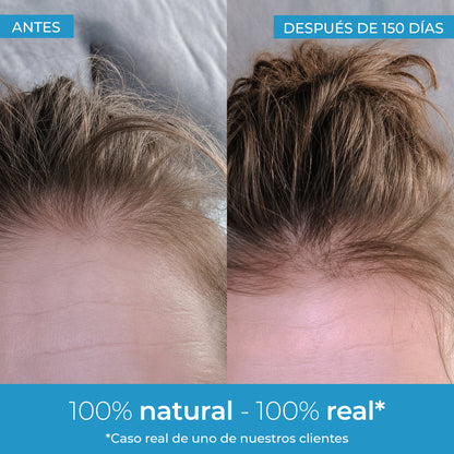 Strength Hair Growth Lotion Arganour 50 ml