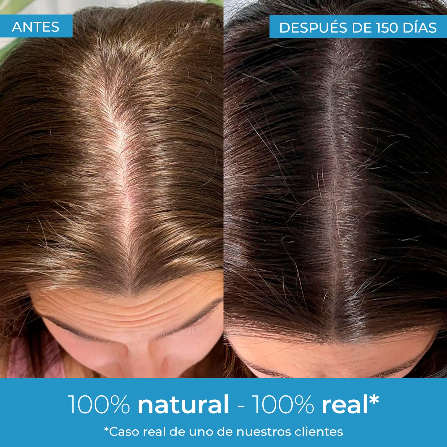 Strength Hair Growth Lotion Arganour 50 ml